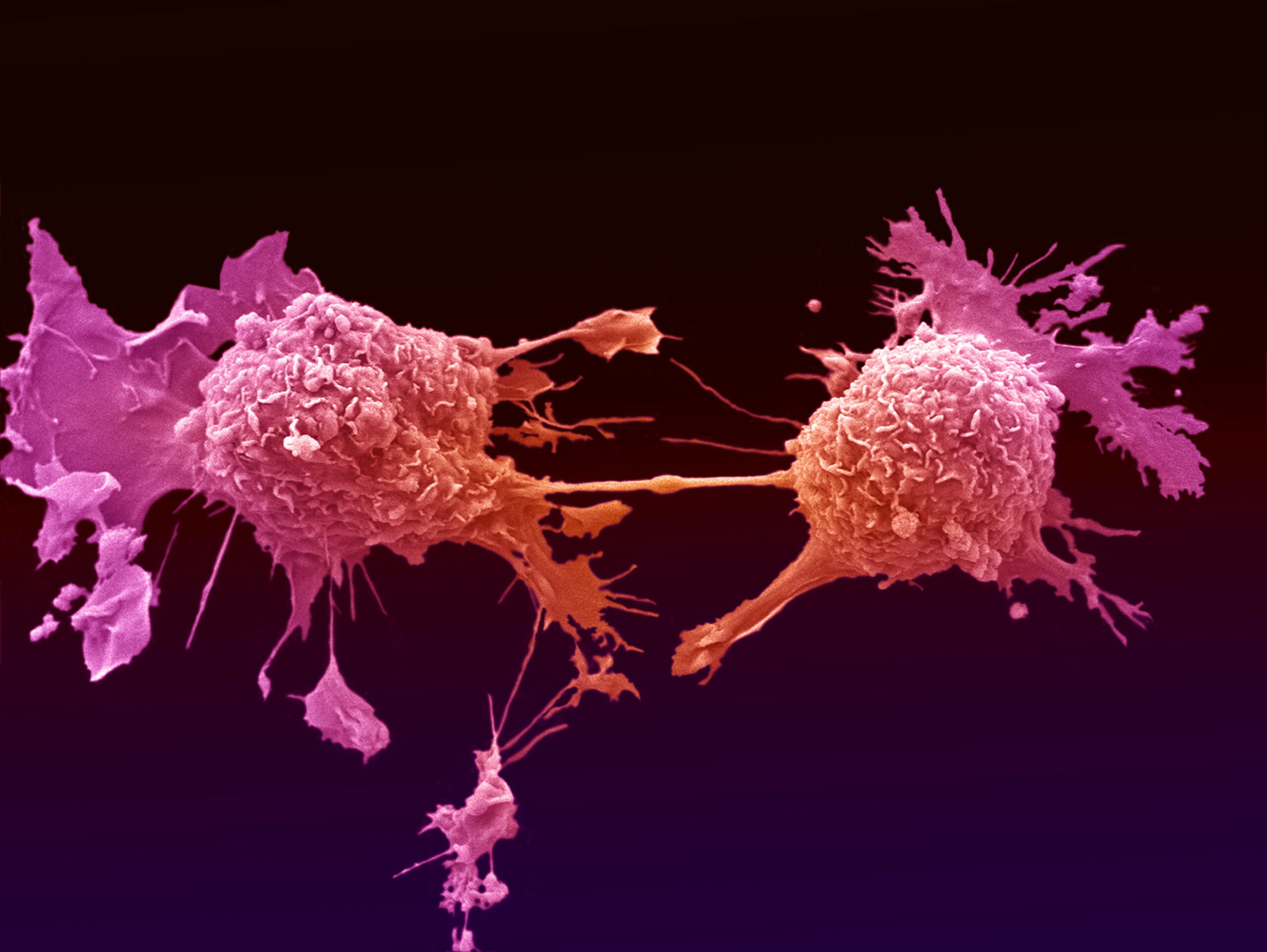 Kemoterapi ilaç tedavisi nedir?